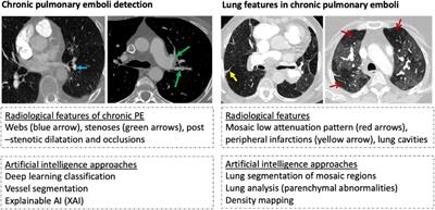 A systematic review of artificial intelligence tools for chronic pulmonary embolism on CT pulmonary angiography